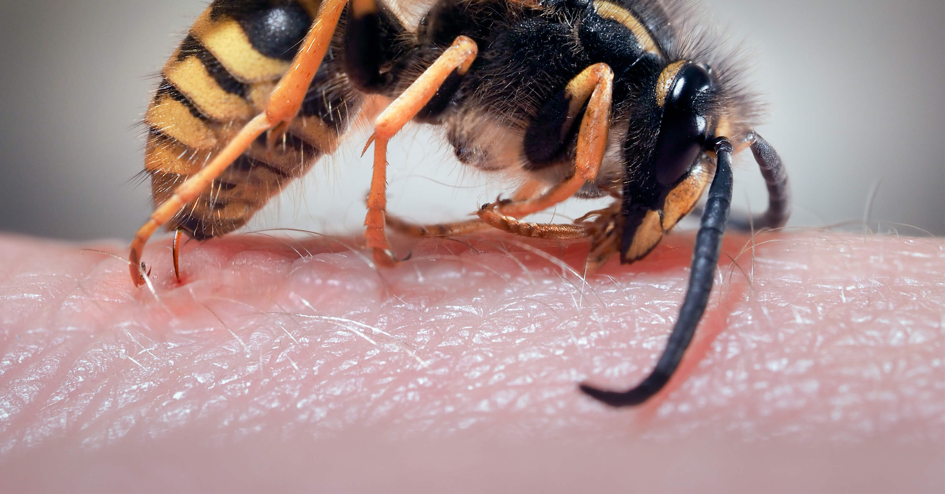 The World’s Most Painful Insect Bites